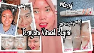 TERNYATA VIT4CID BEGINI !!!!  REVIEW VIT4CID - ACNE STORY