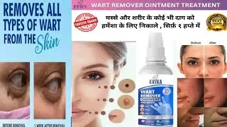 Which cream is best for wart removal? 7 days Wart Removal Cream