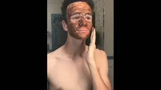 Teen Acne Fighting Routine