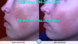 Nerium Reviews: Real Reviews Real Nerium Users