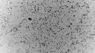 Chicago woman infects husband with coronavirus, first human-to-human spread in US