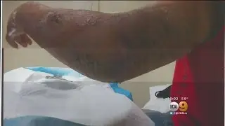Two Men Awarded $1.6M In Long Beach Police Beating