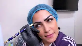 ميكروبليدنج و ميكروشيدنج  لنفسى نانيس سليم ٢