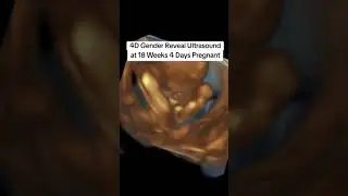 Did you know you can do a Gender Reveal Ultrasound in 4D?! #heybabymobile #18weeks4dayspregnant