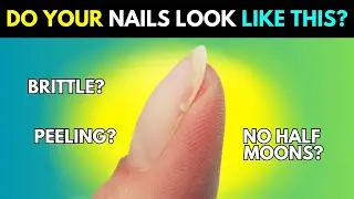 8 Nail Symptoms That Mean You Must Boost Collagen Before It&rsquo;s Too Late
