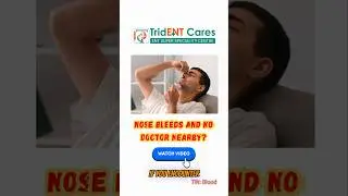Nose bleed and not sure what to do? Watch this now!! #nosebleeds #doctor #treatment