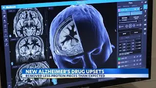 Experimental therapy gantenerumab fails to slow or improve Alzheimer's memory loss in clinical