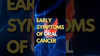 Early symptoms of Oral Cancer | Oral Cancer Signs Explained by DrJamalKhan