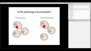 Dr  Anurag Tandon - The spread of alpha synuclein from neuron to neuron HD