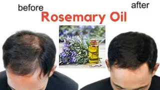 How To Use Rosemary Essential Oil For Hair Growth 30-Day Challenge