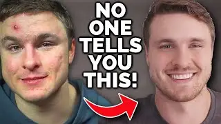 10 Ways To Keep Acne From Shattering Your Self-Esteem...