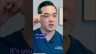 How to fix my tired eyes? #eyelidsurgery #shorts