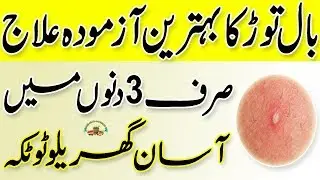 Boils Treatment At Home | Bal Tor Ka Ilaj In Urdu | Boils Ka Ilaj In Urdu | Health Tips