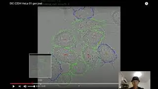 Cell Segmentation and Tracking