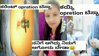 sterilization & laparoscopy operation wich is good ?ಕರೆಂಟ್ ಮತ್ತೆ ಕಯ್ಯಿ opration ಹೇಗೆ ಮಾಡುತ್ತಾರೆ🤔GLDN