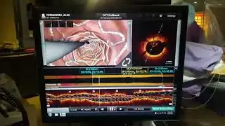 Holy Family Hospital Bandra - OCT Optical Coherence Tomography