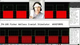 FW-100 Fisher Wallace Cranial Stimulator - taking a look at its waveforms