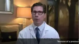 Beverly Hills Revision Rhinoplasty Sugeon - Dr Jay Calvert MD at 310-777-8800 drcalvert.com