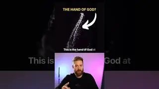 Is this the Hand of God? 16 hour time lapse of a spinal cord