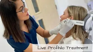 Live Profhilo Skin Boosting Treatment