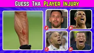 Guess The 35 Football Players by Injury ⚽🤕🩸 | Ultimate Football Quiz 2025 | 35 Questions Challenge