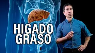 La Epidemia Silenciosa: ¿Tu Hígado te está pidiendo ayuda a gritos? | Sistema Digestivo | Hache