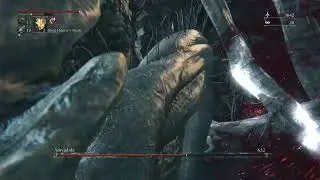 Bloodborne&trade; Defeating Amygdala