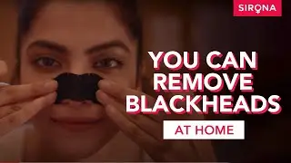 Charcoal Nose Strips | Painless And Instant Removal Of Blackheads and Whiteheads | Sirona