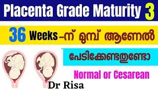 Placenta Grade Maturity 3 | Low Lying Placenta | Placenta Previa
