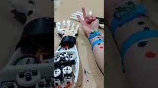Bionic Arm #stemeducation #robotics #coding #stemeducationforkids #stem #arduinoprojects