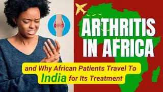 Arthritis in Africa and Why African Patients Travel To India for Its Treatment