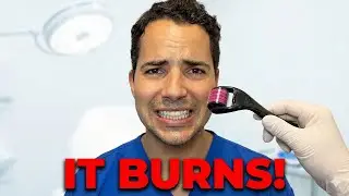 MEN Try SKINCARE : Botox, Microneedling & Sculptra Results (2 Weeks Later)