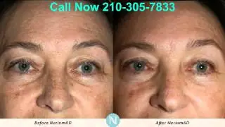 Find a Nerium Representative | 210-305-7833
