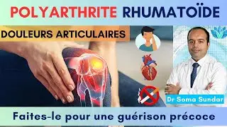 Polyarthrite rhumatoïde : Symptômes et traitement / Explication de la polyarthrite rhumatoïde