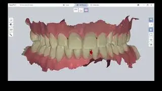 NeoScan Tutorial: Pr&auml;parationsgrenze manuell festlegen
