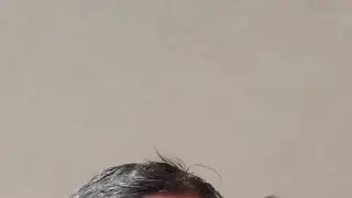 CET protest Live
