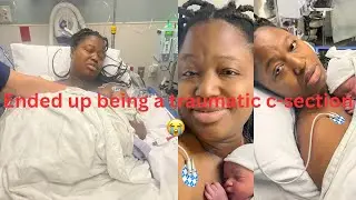 My C-section traumatized me, I missed the entire birth of my son