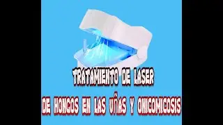 Tratamiento laser de hongos en las u&ntilde;as