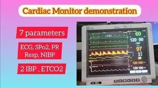 Basics of cardiac monitor /7 PARAMETERS