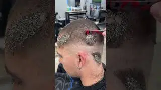 Ce Coiffeur doit Sauver son Client des Poux !✂️