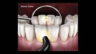 AdDent te presenta el sistema de diagn&oacute;stico Microlux   #addent