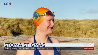 Rachel Sweeney speaks to Gill Castle about taking away the stigma surrounding stomas