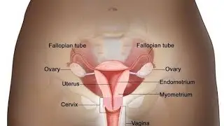 🛑 Live Best Vitamin D Products for PCOS: What Every Woman Must Know &ndash; Dr. Umara