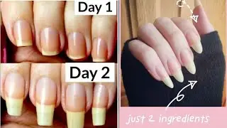 How to Grow Long and Strong Nails in 3 days  | Grow nails Super Fast at home