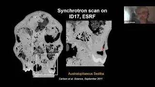 4D high resolution diagnostic imaging and micro-radiosurgery methods with synchrotron radiation