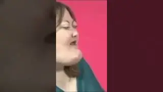 ewww what happened to your face #meme #funny #viral #fypシ #familyguy