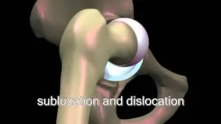 BioRobotics Musculoskeletal Simulator: Hip Stability Measurement Technique