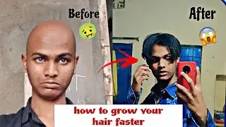 How To Grow Hair Faster | Hair Grow Tips For Men | zehen_vlog