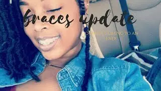 COMING TO AN END!!TWENTY TWO MONTH, BRACES UPDATE|INDCHRONICALS