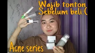 CAPEK NGADEPIN JERAWAT, NYOBAIN MS GLOW SERIES ACNE TERNYATA JADI GINI☹️